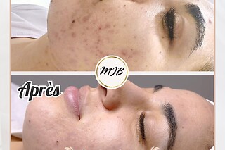 Soin du visage chez MyJaneBeauty à Uccle (Bruxelles-Capitale)